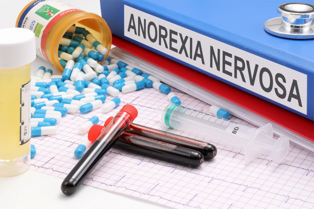 anorexia